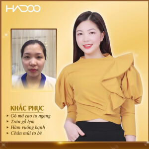 Khách hàng Hadoo 1